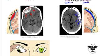 Tips for Before Surgery Preparation  St Mary Medical Center [upl. by Aiblis]